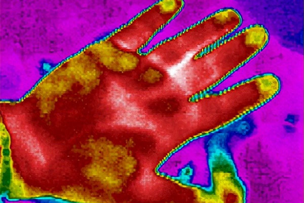 醫用紅外熱成像技術的醫療應用
